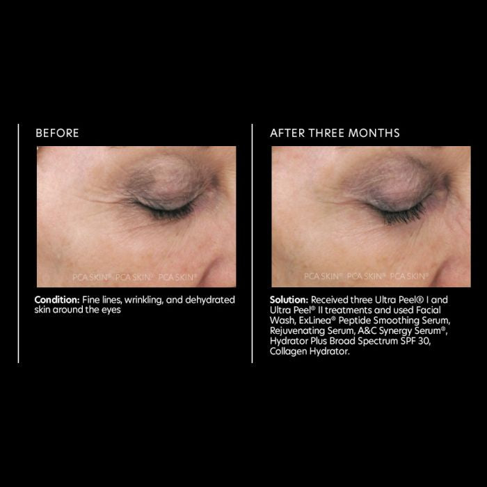 PCA Skin Rejuvenating Serum