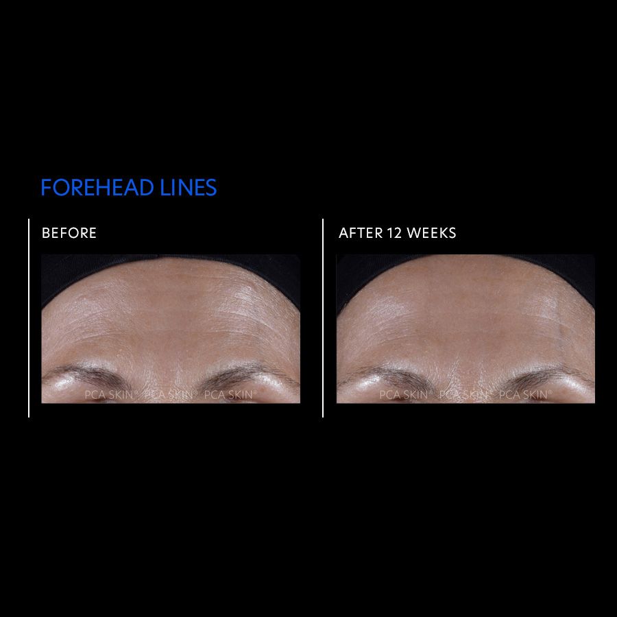 PCA Skin ExLinea Pro Peptide Serum