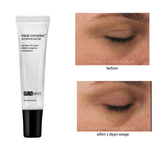 PCA Skin Ideal Complex revitalizing eye gel