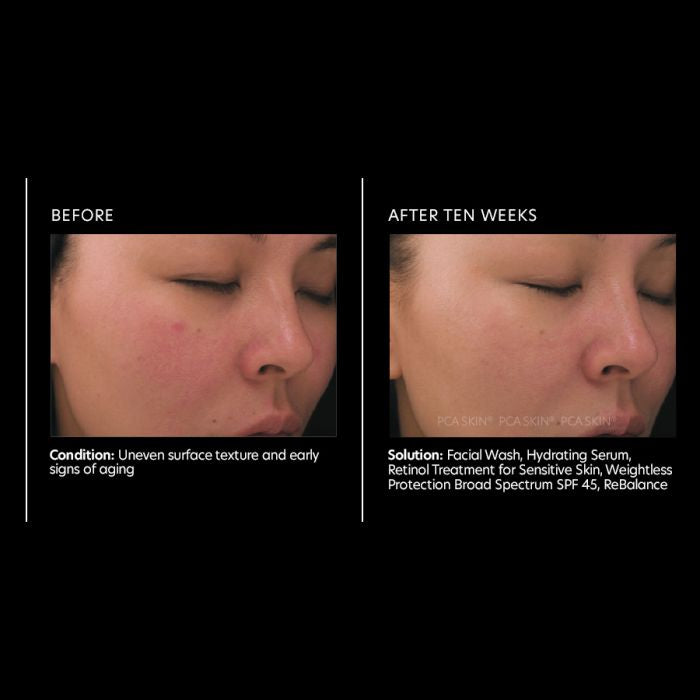 PCA Skin Retinol treatment for sensitive skin