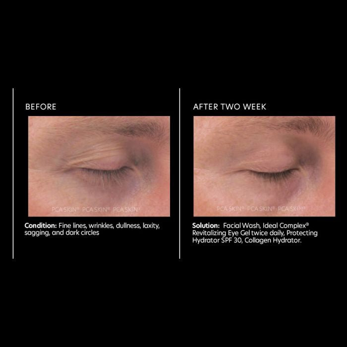 PCA Skin Ideal Complex revitalizing eye gel