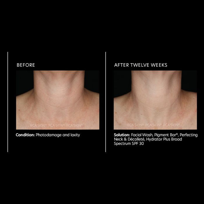 PCA Skin Perfecting Neck & Dècolletè